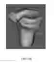 Fig. 36 - System and method for image segmentation in generating computer models of a joint to undergo arthroplasty