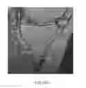 Fig. 38 - System and method for image segmentation in generating computer models of a joint to undergo arthroplasty
