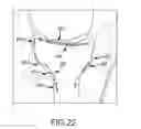 Fig. 48 - System and method for image segmentation in generating computer models of a joint to undergo arthroplasty