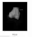 Fig. 53 - System and method for image segmentation in generating computer models of a joint to undergo arthroplasty