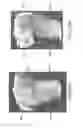 Fig. 58 - System and method for image segmentation in generating computer models of a joint to undergo arthroplasty