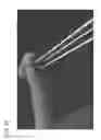 Fig. 26 - Bone drill guides and methods of use thereof