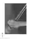 Fig. 31 - Bone drill guides and methods of use thereof