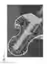Fig. 33 - Bone drill guides and methods of use thereof