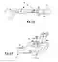 Fig. 06 - Method and apparatus for orthopedic fixation