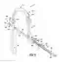 Fig. 12 - Method and apparatus for orthopedic fixation