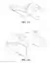 Fig. 04 - Shoulder base plate coverage and stability