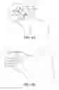Fig. 05 - Shoulder base plate coverage and stability
