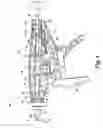 Fig. 07 - Needlescopic instrument with reusable handle and detachable needle assembly