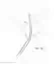 Fig. 04 - Multi fluid tissue resection methods and devices