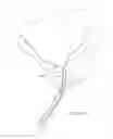 Fig. 05 - Multi fluid tissue resection methods and devices