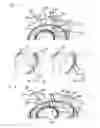 Fig. 06 - Needle positioning apparatus
