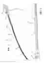 Fig. 02 - Expandable introducer sheath