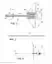 Fig. 03 - Surgical navigation