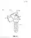 Fig. 06 - MENISCAL REPOSITIONING DEVICE