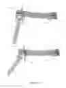Fig. 11 - PressOn Pedicle Screw Variations