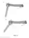 Fig. 12 - PressOn Pedicle Screw Variations
