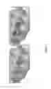 Fig. 18 - PressOn Pedicle Screw Variations
