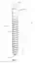 Fig. 03 - Composite material spinal implant