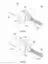 Fig. 52 - Composite material spinal implant