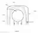 Fig. 56 - Composite material spinal implant