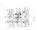 Fig. 09 - Adjustable spinous process spacer device and method of treating spinal disorders