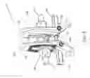 Fig. 10 - Adjustable spinous process spacer device and method of treating spinal disorders