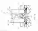 Fig. 14 - Adjustable spinous process spacer device and method of treating spinal disorders