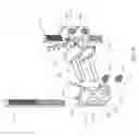 Fig. 21 - Adjustable spinous process spacer device and method of treating spinal disorders