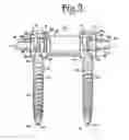 Fig. 04 - Dynamic spinal stabilization assemblies, tool set and method