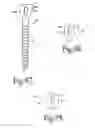 Fig. 17 - Dynamic spinal stabilization assemblies, tool set and method