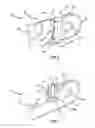Fig. 03 - Pectus bar stabilizer