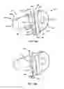 Fig. 11 - Pectus bar stabilizer