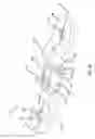 Fig. 15 - Pectus bar stabilizer