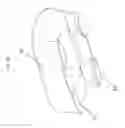 Fig. 11 - FLEXIBLE LOCKED PLATE FIXATION