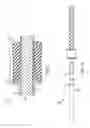 Fig. 09 - WOVEN RETENTION DEVICES, SYSTEMS, PACKAGING, AND RELATED METHODS
