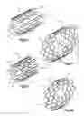 Fig. 04 - Expandable Bone Implant