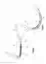 Fig. 12 - Expandable Bone Implant