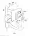 Fig. 07 - Balloon design to enhance cooling uniformity