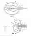 Fig. 09 - Balloon design to enhance cooling uniformity