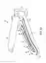Fig. 04 - Methods and devices for creating thermal zones within an electrosurgical instrument