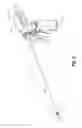 Fig. 03 - Aseptic transfer devices, systems, and methods for maintaining the sterility of surgical instruments