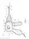 Fig. 02 - Deployment mechanisms for surgical instruments