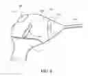 Fig. 07 - Deployment mechanisms for surgical instruments
