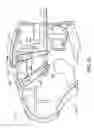 Fig. 13 - Deployment mechanisms for surgical instruments