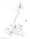 Fig. 02 - Deployment mechanisms for surgical instruments