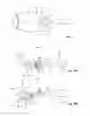 Fig. 07 - Deployment mechanisms for surgical instruments