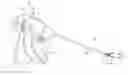 Fig. 01 - Deployment mechanisms for surgical instruments