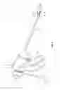 Fig. 02 - Deployment mechanisms for surgical instruments