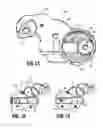 Fig. 11 - Surgical instrument having a bipolar end effector assembly and a deployable monopolar assembly